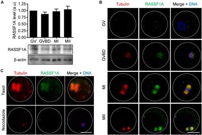 RASSF1A Regulates Spindle Organization by Modulating Tubulin Acetylation via SIRT2 and HDAC6 in Mouse Oocytes